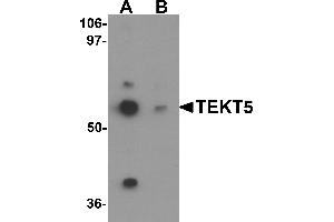 Western blot analysis of TEKT5 in 3T3 cell lysate with TEKT5 antibody at 0.
