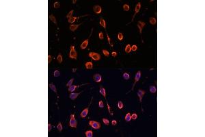 Immunofluorescence analysis of L929 cells using MT- antibody (ABIN7268593) at dilution of 1:100.