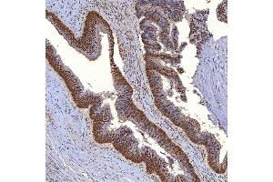 IHC analysis of TRMT61A using anti-TRMT61A antibody (ABIN7599220). (TRMT61A anticorps  (AA 1-289))