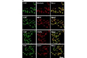 Vesicular nucleotide transporter (VNUT) was present in the dense granules of human platelets.