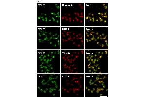 Vesicular nucleotide transporter (VNUT) was present in the dense granules of human platelets. (LAMP1 anticorps)