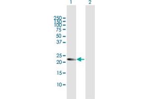 Western Blot analysis of AMN1 expression in transfected 293T cell line by AMN1 MaxPab polyclonal antibody.
