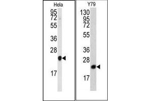 Image no. 1 for anti-Phosphatidylethanolamine Binding Protein 1 (PEBP1) (N-Term) antibody (ABIN360563) (PEBP1 anticorps  (N-Term))