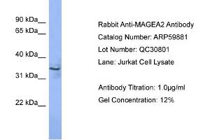 WB Suggested Anti-MAGEA2  Antibody Titration: 0. (MAGEA2 anticorps  (N-Term))