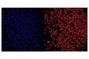 IF analysis of RCC1 using anti-RCC1 antibody (ABIN7600024). (RCC1 anticorps  (AA 14-421))