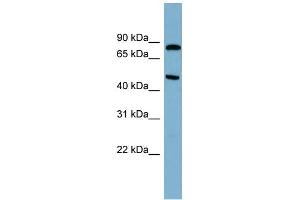 WB Suggested Anti-PANK4 Antibody Titration: 0.