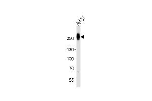 Western blot analysis of lysate from A431 cell line, using MYH14 Antibody at 1:1000. (Myosin anticorps  (AA 654-668))