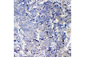 IHC analysis of IQGAP2 using antiIQGAP2 antibody (ABIN5692877). (IQGAP2 anticorps  (AA 1329-1544))