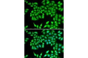 Immunofluorescence analysis of U2OS cell using MCM3 antibody. (MCM3 anticorps)