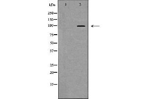 Western blot analysis of extracts of mouse fetal brain , using NFATC2antibody.