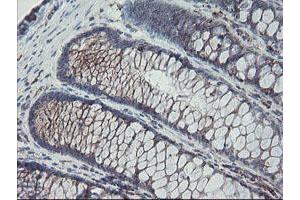 Image no. 10 for anti-Carboxypeptidase A2 (Pancreatic) (CPA2) antibody (ABIN1497596)