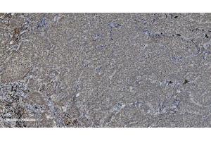 IHC analysis of PARP using anti-PARP antibody (ABIN7602277). (PARP1 anticorps  (AA 670-858))