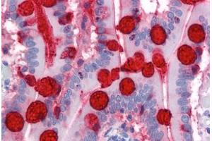 anti-Trefoil Factor 3 (Intestinal) (TFF3) (AA 15-74) antibody