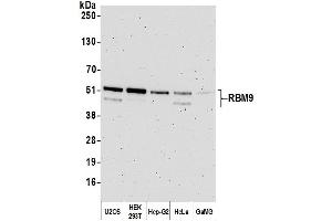Western Blotting (WB) image for anti-RNA Binding Motif Protein 9 (RBM9) (AA 1-50) antibody (ABIN7454680)