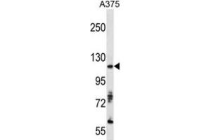 Western Blotting (WB) image for anti-AXL Receptor tyrosine Kinase (AXL) antibody (ABIN3003321)