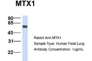 Host:  Rabbit  Target Name:  MTX1  Sample Type:  Human Fetal Lung  Antibody Dilution:  1. (Metaxin 1 anticorps  (C-Term))