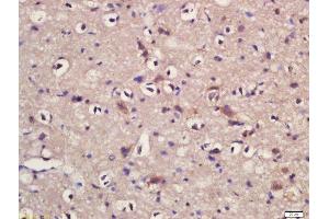 Formalin-fixed and paraffin embedded rat brain labeled with Rabbit Anti-KLC1/KNS2 Polyclonal Antibody, Unconjugated (ABIN1385823) at 1:200 followed by conjugation to the secondary antibody and DAB staining (KLC1 anticorps  (AA 1-100))