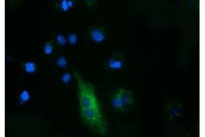 Anti-FSHB mouse monoclonal antibody (ABIN2453055) immunofluorescent staining of COS7 cells transiently transfected by pCMV6-ENTRY FSHB (RC214616). (FSHB anticorps)