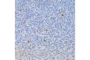 Immunohistochemistry of paraffin-embedded human tonsil using FCN1 Antibody (ABIN5973958) at dilution of 1/100 (40x lens). (FCN1 anticorps)