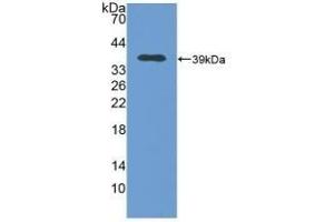 Detection of Recombinant MT2, Human using Polyclonal Antibody to Metallothionein 2 (MT2)