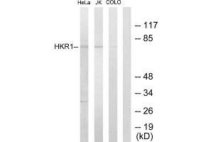Western blot analysis of extracts from HeLa cells, Jurkat cells and COLO205 cells, using HKR1 antibody. (HKR1 anticorps  (Internal Region))