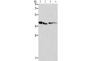 Western Blotting (WB) image for anti-Branched Chain Amino-Acid Transaminase 2, Mitochondrial (BCAT2) antibody (ABIN2422985)