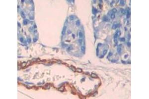 IHC-P analysis of Human Tissue, with DAB staining. (LRP3 anticorps  (AA 184-435))