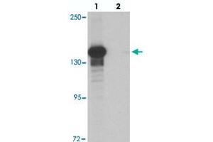 Western blot analysis of KDM6B in K-562 cell lysate with KDM6B polyclonal antibody  at 0. (Kdm6b anticorps  (N-Term))