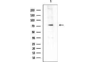Western blot analysis of lysates from Mouse testis, using RHG18 Antibody at 1/1000 dilution.