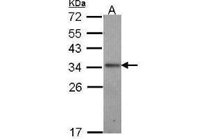 WB Image Sample (30 ug of whole cell lysate) A: A431 , 12% SDS PAGE antibody diluted at 1:1000 (IL-24 anticorps  (C-Term))