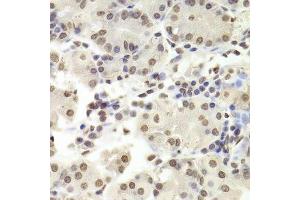 Immunohistochemistry of paraffin-embedded human stomach using RUVBL1 Antibody. (RUVBL1 anticorps  (AA 1-240))