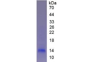 SDS-PAGE analysis of Human Fibrinogen alpha Protein. (FGA Protéine)