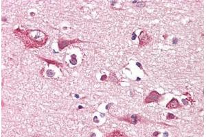 Anti-PLCG1 antibody IHC staining of human brain, cortex.