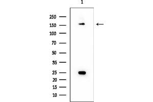 anti-TAO Kinase 2 (TAOK2) (Internal Region) antibody