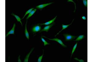 Immunofluorescence staining of Hela cells with ABIN7153745 at 1:133, counter-stained with DAPI. (GMDS anticorps  (AA 243-346))