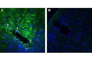 Expression of GPR143 in mouse striatum. (GPR143 anticorps  (Intracellular))
