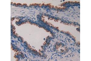 IHC-P analysis of prostate gland tissue, with DAB staining. (PLAA anticorps  (AA 534-792))