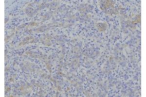 ABIN6276937 at 1/100 staining Human gastric tissue by IHC-P. (SLC25A4 anticorps  (Internal Region))