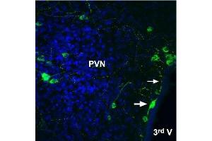 Expression of Angiotensin II receptor type-2 in rat brain - Immunohistochemical staining of rat frozen free floating brain sections using Anti-Angiotensin II Receptor Type-2 (extracellular)-ATTO Fluor-488 Antibody (ABIN7042926), (1:20).