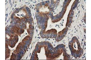 Image no. 9 for anti-Breast Cancer Anti-Estrogen Resistance 1 (BCAR1) antibody (ABIN1496834)