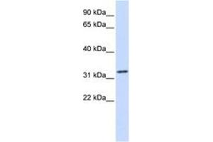 Image no. 1 for anti-Tropomyosin alpha-1 Chain (TM7) (C-Term) antibody (ABIN6743064) (TM7 anticorps  (C-Term))