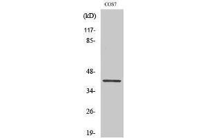 Western Blotting (WB) image for anti-GATA Binding Protein 1 (Globin Transcription Factor 1) (GATA1) (pSer310) antibody (ABIN3182019) (GATA1 anticorps  (pSer310))
