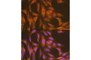 Immunofluorescence analysis of C6 cells using U Rabbit mAb (ABIN7271211) at dilution of 1:100 (40x lens). (UAP1 anticorps)