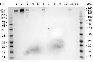Western Blot of Rabbit anti-ROBO1 antibody.