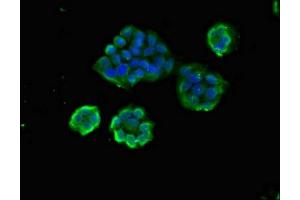 Immunofluorescent analysis of PC-3 cells using ABIN7144564 at dilution of 1:100 and Alexa Fluor 488-congugated AffiniPure Goat Anti-Rabbit IgG(H+L)