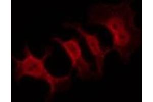 ABIN6269089 staining HeLa by IF/ICC. (APP anticorps  (C-Term))