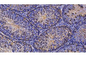 Detection of PRDX2 in Mouse Testis Tissue using Polyclonal Antibody to Peroxiredoxin 2 (PRDX2) (Peroxiredoxin 2 anticorps  (AA 6-164))