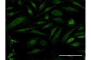 Immunofluorescence of monoclonal antibody to EIF1AY on HeLa cell. (EIF1AY anticorps  (AA 31-120))