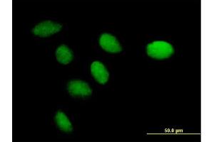 Immunofluorescence of purified MaxPab antibody to CENPK on HeLa cell. (CENPK anticorps  (AA 1-269))