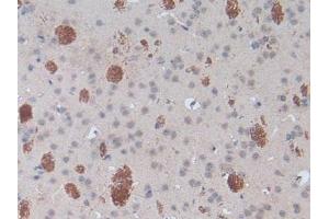 Detection of SPRY1 in Mouse Brain Tissue using Polyclonal Antibody to Sprouty Homolog 1 (SPRY1)